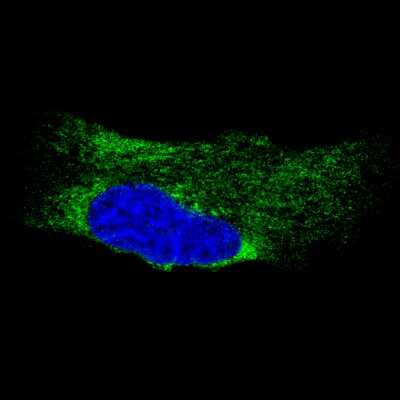 Immunocytochemistry/ Immunofluorescence: Metadherin Antibody (CL0397) [NBP2-52929]