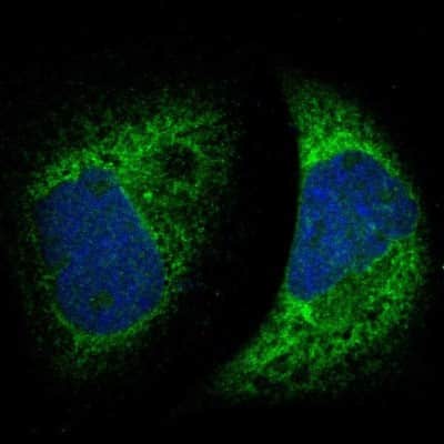 Immunocytochemistry/ Immunofluorescence: Metadherin Antibody [NBP1-90328]
