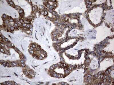 Immunohistochemistry: Metadherin Antibody (OTI1B6) - Azide and BSA Free [NBP2-72552]
