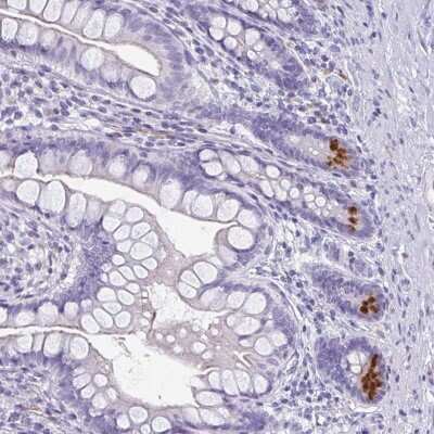 Immunohistochemistry: LYRM2 Antibody [NBP2-38033]