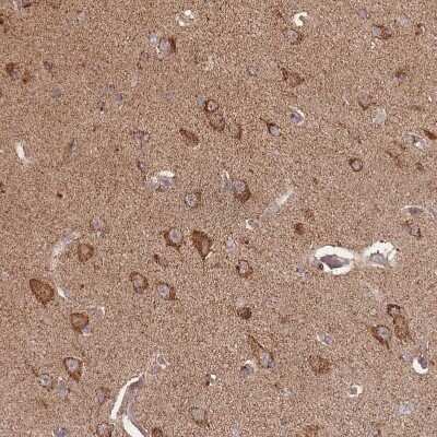 Immunohistochemistry-Paraffin: LYRM7 Antibody [NBP2-14701]
