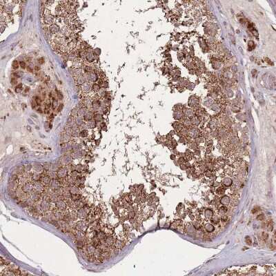 Immunohistochemistry-Paraffin: LYRM7 Antibody [NBP2-14701]