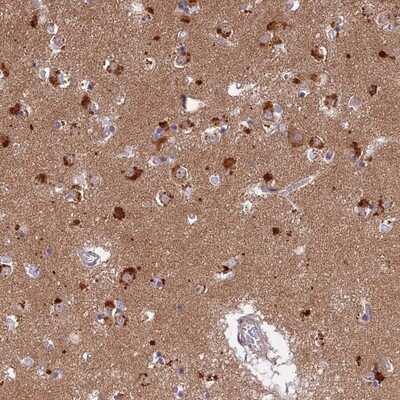 Immunohistochemistry-Paraffin: LYSMD2 Antibody [NBP1-82702]