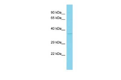 Western Blot: LYSMD3 Antibody [NBP2-83168]