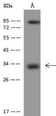 Western Blot: LYSMD3 Antibody [NBP3-12606]