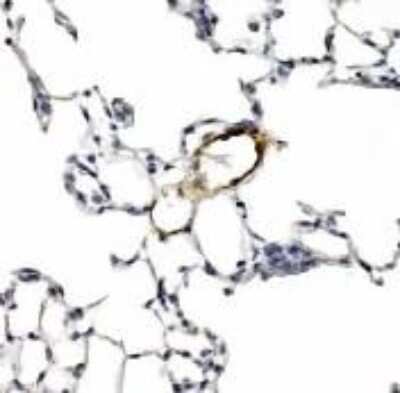 Immunohistochemistry: LYVE-1 Antibody - BSA Free [NB100-725]