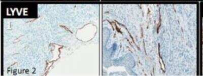 Immunohistochemistry: LYVE-1 Antibody [NB600-1008]