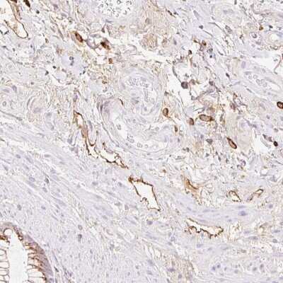 Immunohistochemistry-Paraffin: LYVE-1 Antibody [NBP2-38500]