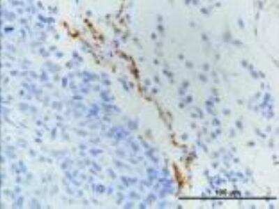 Immunohistochemistry-Paraffin: LYVE-1 Antibody - BSA Free [NB100-725]