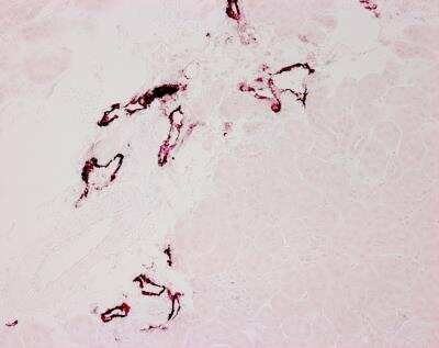 Immunohistochemistry-Paraffin: LYVE-1 Antibody [NB600-1008]