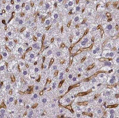 Immunohistochemistry-Paraffin: LYVE-1 Antibody [NB600-1008]