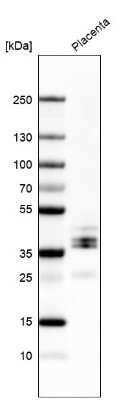 Western Blot: LYVE-1 Antibody [NBP2-38500]