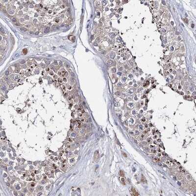 Immunohistochemistry-Paraffin: LYZL4 Antibody [NBP1-81279]