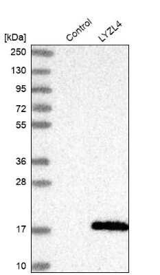 Western Blot: LYZL4 Antibody [NBP1-81279]