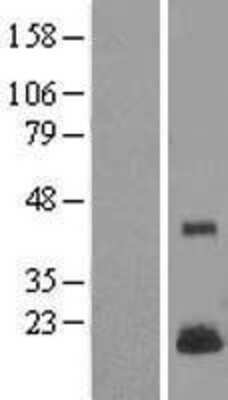 Western Blot: LYZL4 Overexpression Lysate [NBL1-12773]