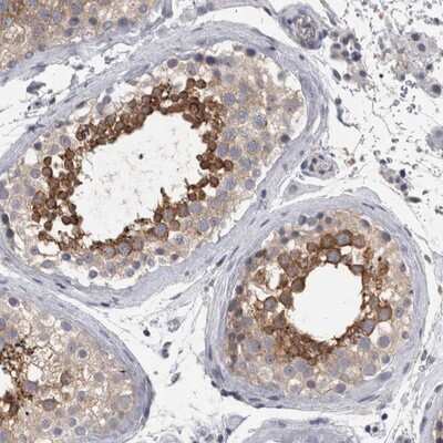 Immunohistochemistry-Paraffin: LYZL6 Antibody [NBP1-82810]