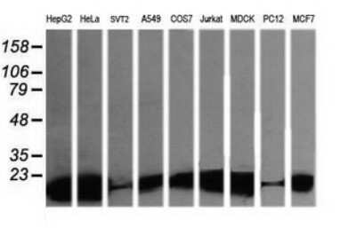 Western Blot: LZIC Antibody (OTI5E3) [NBP2-45796]