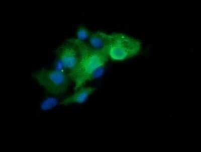 Immunocytochemistry/ Immunofluorescence: LZIC Antibody (OTI2D4) - Azide and BSA Free [NBP2-72560]