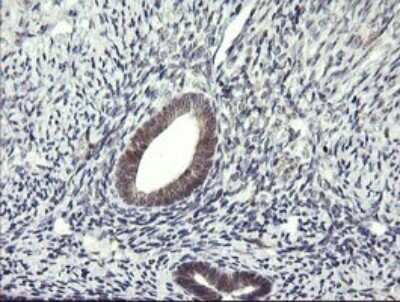 Immunohistochemistry: LZIC Antibody (OTI2D4) [NBP2-45704]