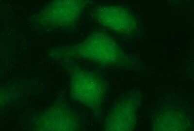 Immunocytochemistry/ Immunofluorescence: LZIC Antibody (OTI3A7) - Azide and BSA Free [NBP2-72559]
