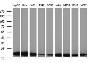 Western Blot: LZIC Antibody (OTI3A7)Azide and BSA Free [NBP2-72559]