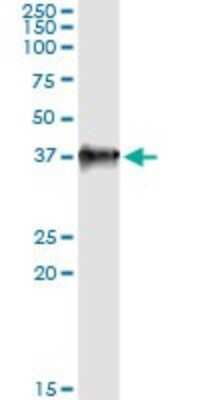 Western Blot: LZTFL1 Antibody (1B1) [H00054585-M09]