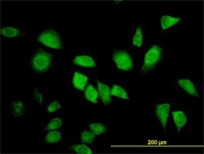 Immunocytochemistry/ Immunofluorescence: LZTFL1 Antibody (7F6) [H00054585-M01]