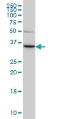 Western Blot: LZTFL1 Antibody (7F6) [H00054585-M01]