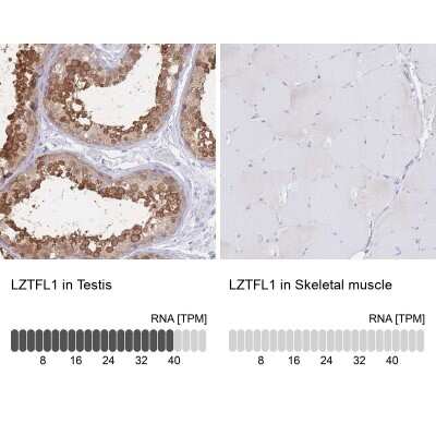Immunohistochemistry-Paraffin: LZTFL1 Antibody [NBP2-30690]