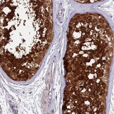 Immunohistochemistry-Paraffin: LZTFL1 Antibody [NBP2-47387]
