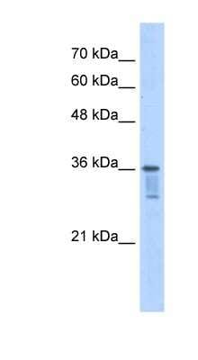 Western Blot: LZTFL1 Antibody [NBP1-55520]