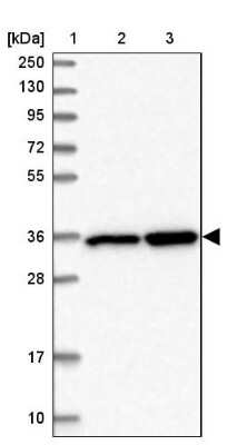 Western Blot: LZTFL1 Antibody [NBP2-47387]