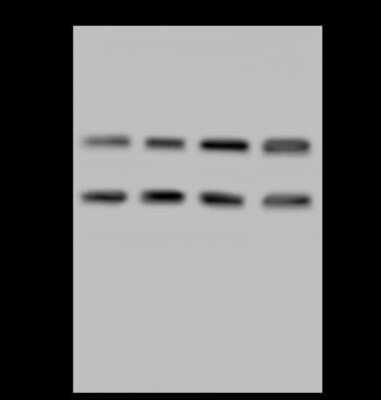 Western Blot: LZTFL1 Antibody [NBP2-97499]