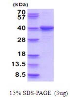 SDS-PAGE: Recombinant Human LZTFL1 His Protein [NBP2-51936]