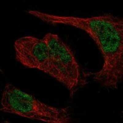 Immunocytochemistry/ Immunofluorescence: LZTR1 Antibody [NBP3-17734]