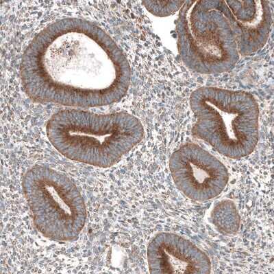 Immunohistochemistry-Paraffin: LZTR1 Antibody [NBP2-49649]