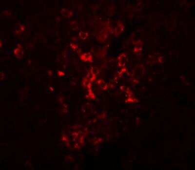 Immunocytochemistry/ Immunofluorescence: LZTR2 Antibody - BSA Free [NBP1-77122]