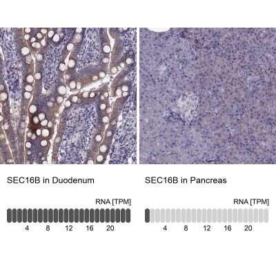 Immunohistochemistry-Paraffin: LZTR2 Antibody [NBP2-62678]