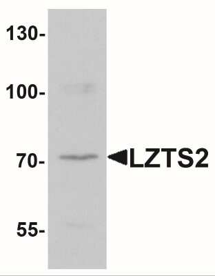 Western Blot: LZTS2 AntibodyBSA Free [NBP2-41152]