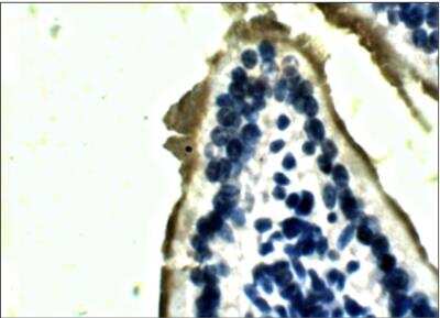 Immunohistochemistry-Paraffin: Lactase Antibody [NBP3-12238]