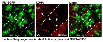 Immunohistochemistry: Lactate Dehydrogenase A/LDHA Antibody - BSA Free [NBP1-48336]