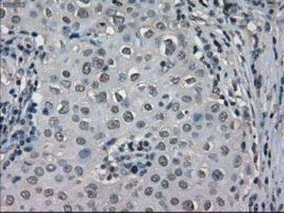Immunohistochemistry-Paraffin: Lactate Dehydrogenase A/LDHA Antibody (OTI2D11) [NBP1-47822]