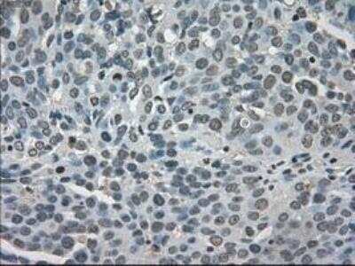 Immunohistochemistry-Paraffin: Lactate Dehydrogenase A/LDHA Antibody (OTI2D11) [NBP1-47822]