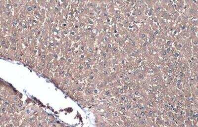 Immunohistochemistry-Paraffin: Lactate Dehydrogenase A/LDHA Antibody [NBP2-19320]