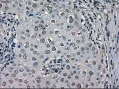 Immunohistochemistry: Lactate Dehydrogenase A/LDHA Antibody (OTI2D11) - Azide and BSA Free [NBP2-71121]