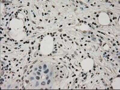 Immunohistochemistry: Lactate Dehydrogenase A/LDHA Antibody (OTI2D11) - Azide and BSA Free [NBP2-71121]