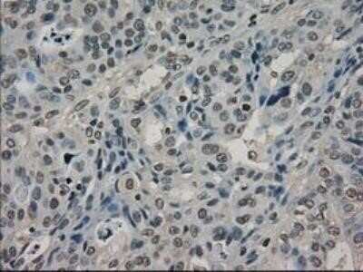 Immunohistochemistry: Lactate Dehydrogenase A/LDHA Antibody (OTI2D11) - Azide and BSA Free [NBP2-71121]