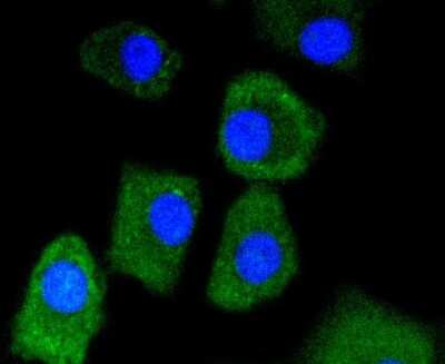 Immunocytochemistry/ Immunofluorescence: Lactate Dehydrogenase A/LDHA Antibody (SU39-06) [NBP2-67483]