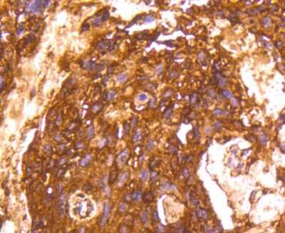 Immunohistochemistry-Paraffin: Lactate Dehydrogenase A/LDHA Antibody (SU39-06) [NBP2-67483]