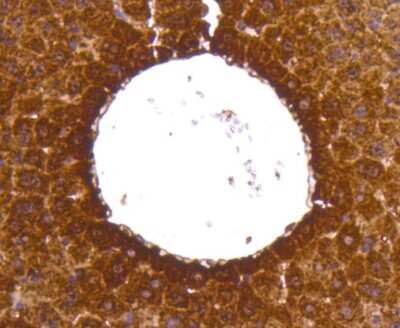 Immunohistochemistry-Paraffin: Lactate Dehydrogenase A/LDHA Antibody (SU39-06) [NBP2-67483]